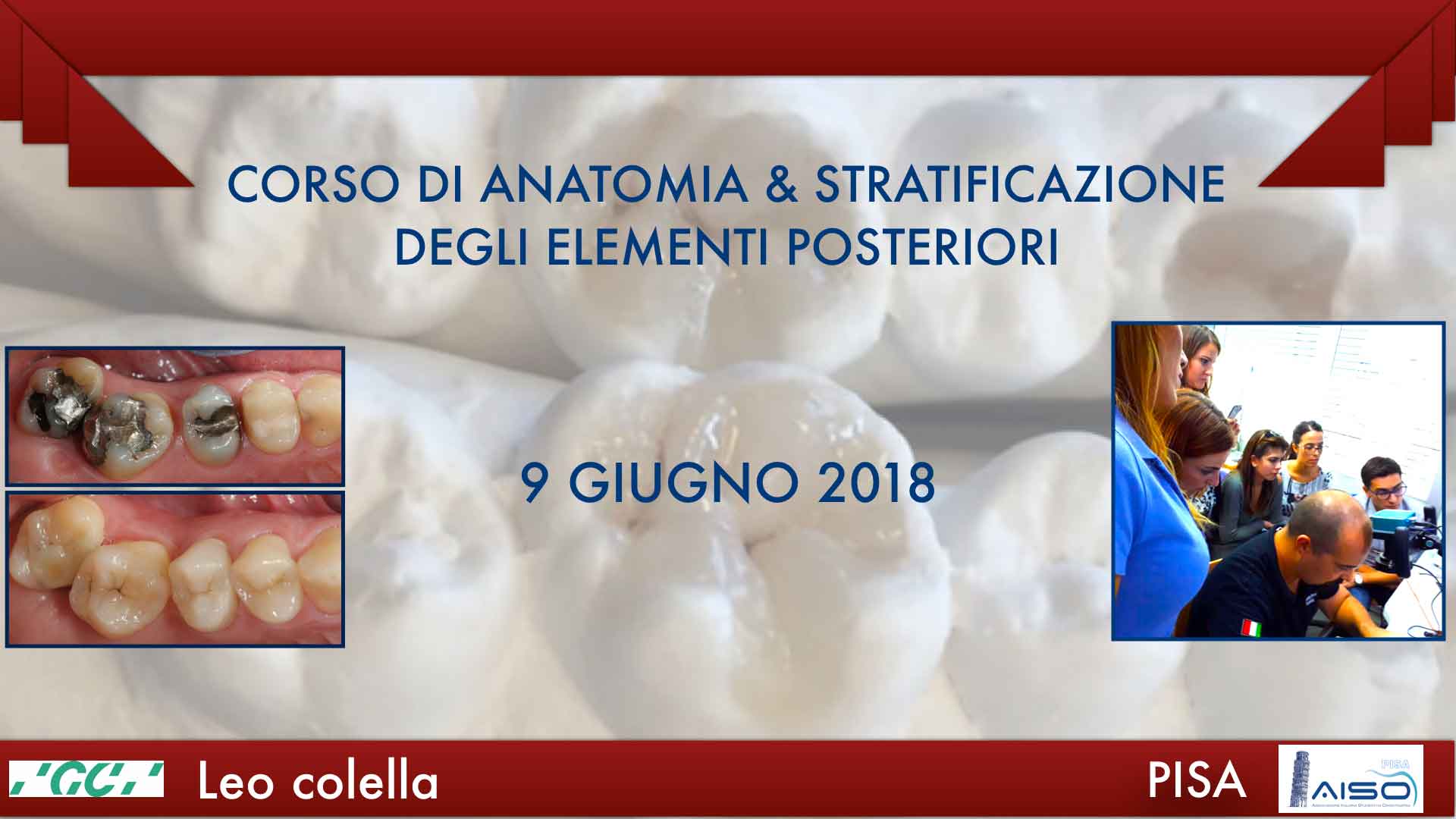 Corso di anatomia e stratificazione degli elementi posteriori - 9 Giugno 2018