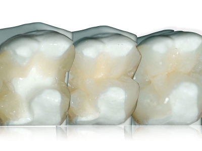 stratificazione-dentina